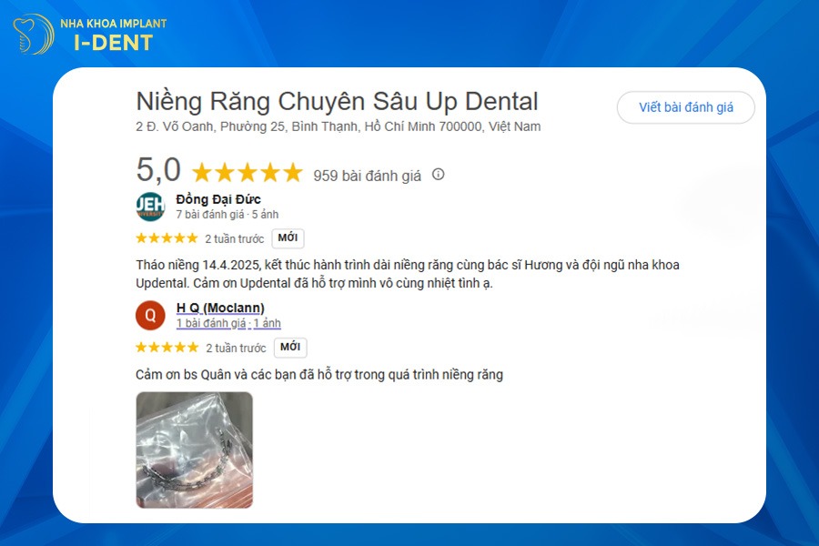 nha khoa niềng răng uy tín tphcm​