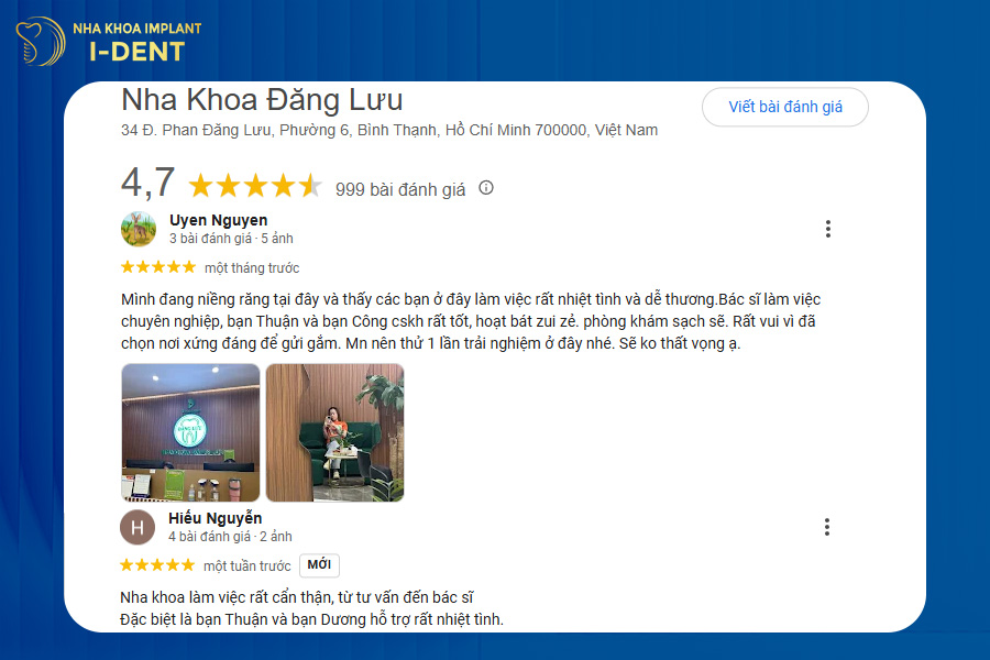 niềng răng ở đâu tốt tại bình thạnh