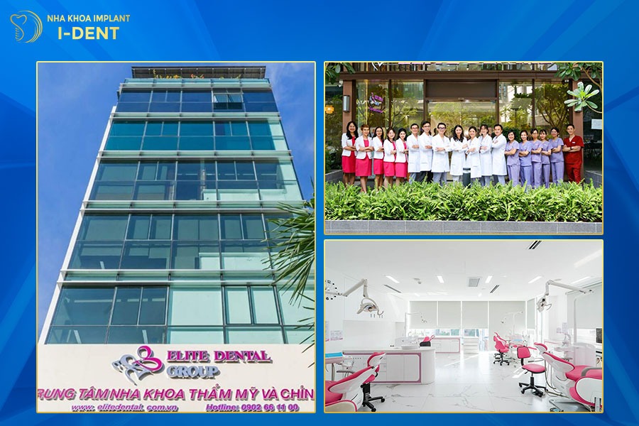 niềng răng ở đâu tốt tại tphcm​