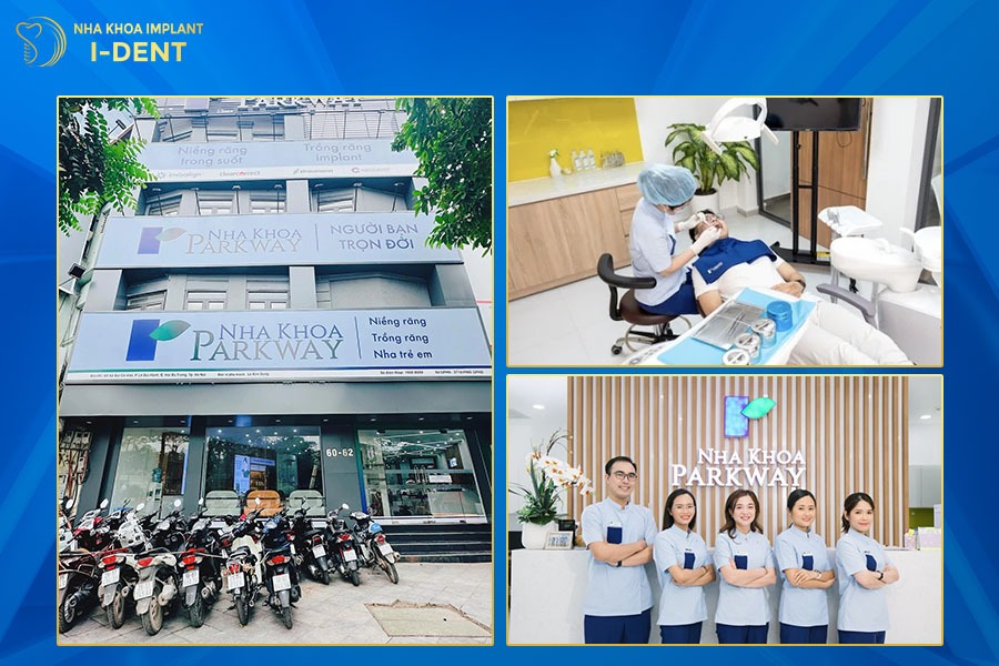 niềng răng tốt tphcm​