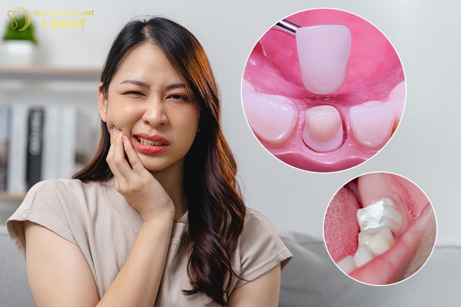 trồng răng bắc cầu bao nhiêu tiền