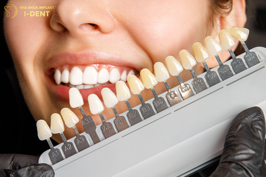 16 tone màu tiêu chuẩn răng sứ katana