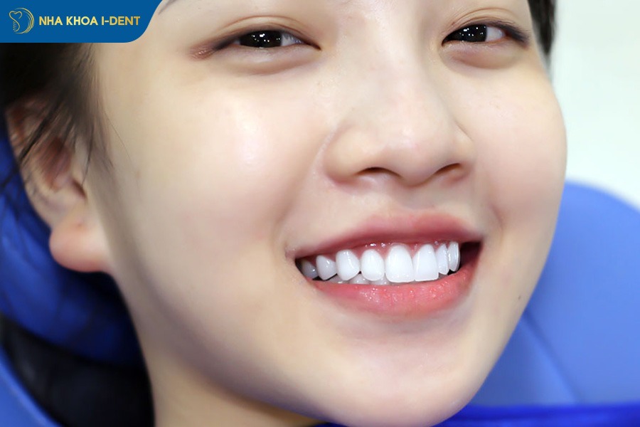 răng sứ răng thỏ