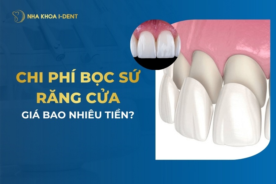 Chi Phí Bọc Răng Sứ 2 Răng Cửa Giá Bao Nhiêu Tiền?