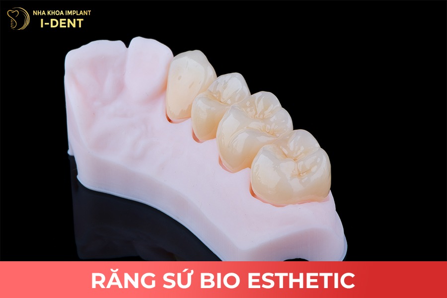 Răng sứ toàn sứ Bio Esthetic