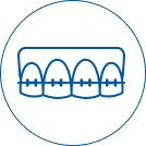 Tái khám định kỳ (1 tháng/1 lần) & tiến hành chỉnh nha theo kế hoạch của bác sĩ