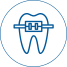  Vệ sinh  & gắn khí cụ chỉnh nha
