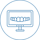 Mô phỏng kết quả bằng phần mềm ClinCheck