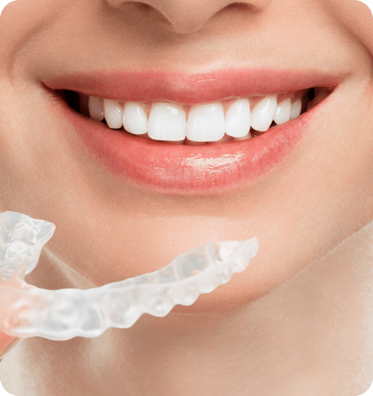 NIỀNG RĂNG TRONG SUỐT INVISALIGN