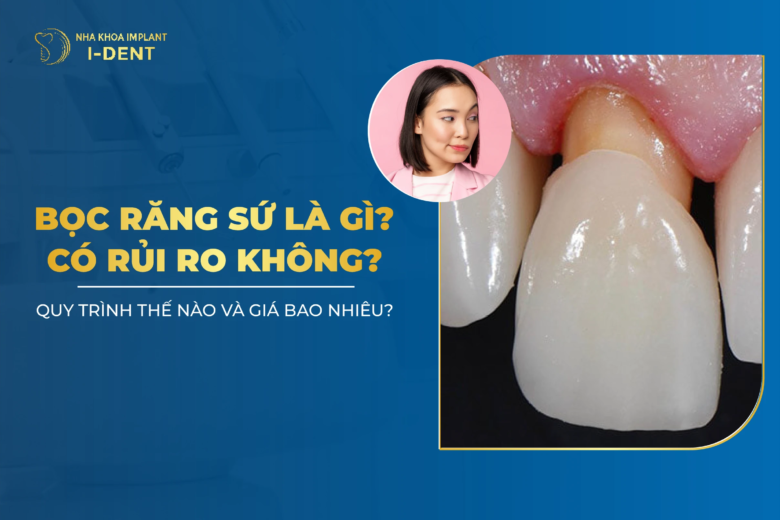 Bọc Răng Sứ Là Gì? Cách Thực Hiện? Có Nên Bọc Sứ?
