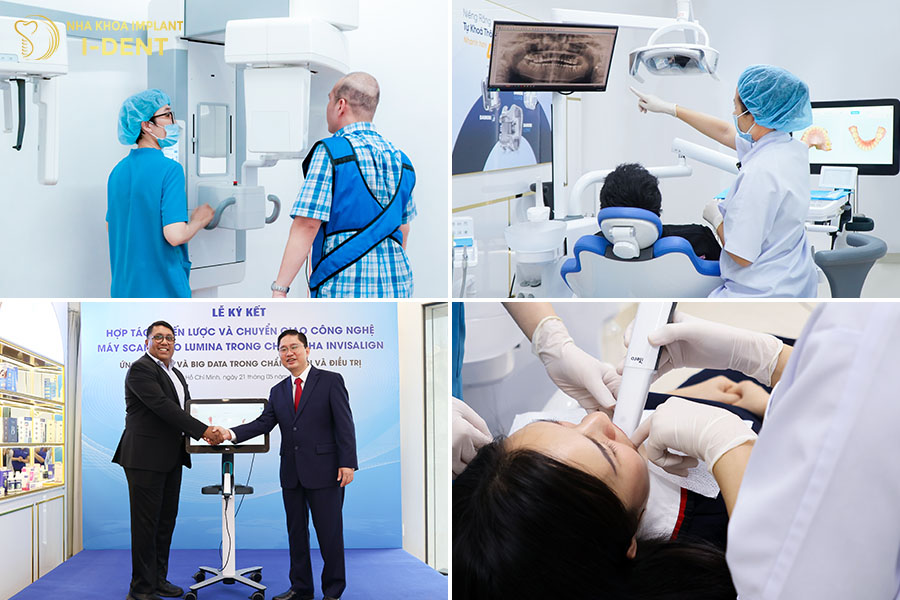 niềng răng không mắc cài bao nhiêu tiền