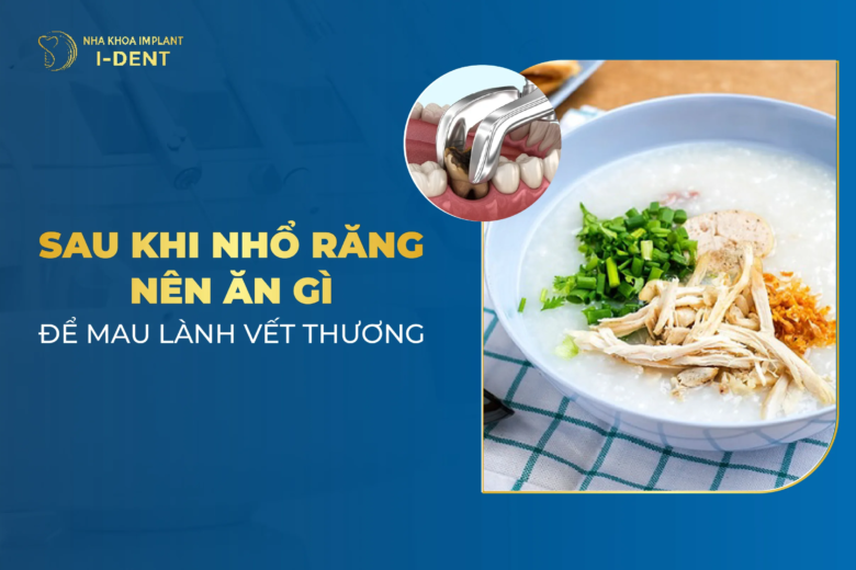 Nhổ Răng Kiêng Ăn Gì Và Nên Ăn Gì Để Mau Lành?