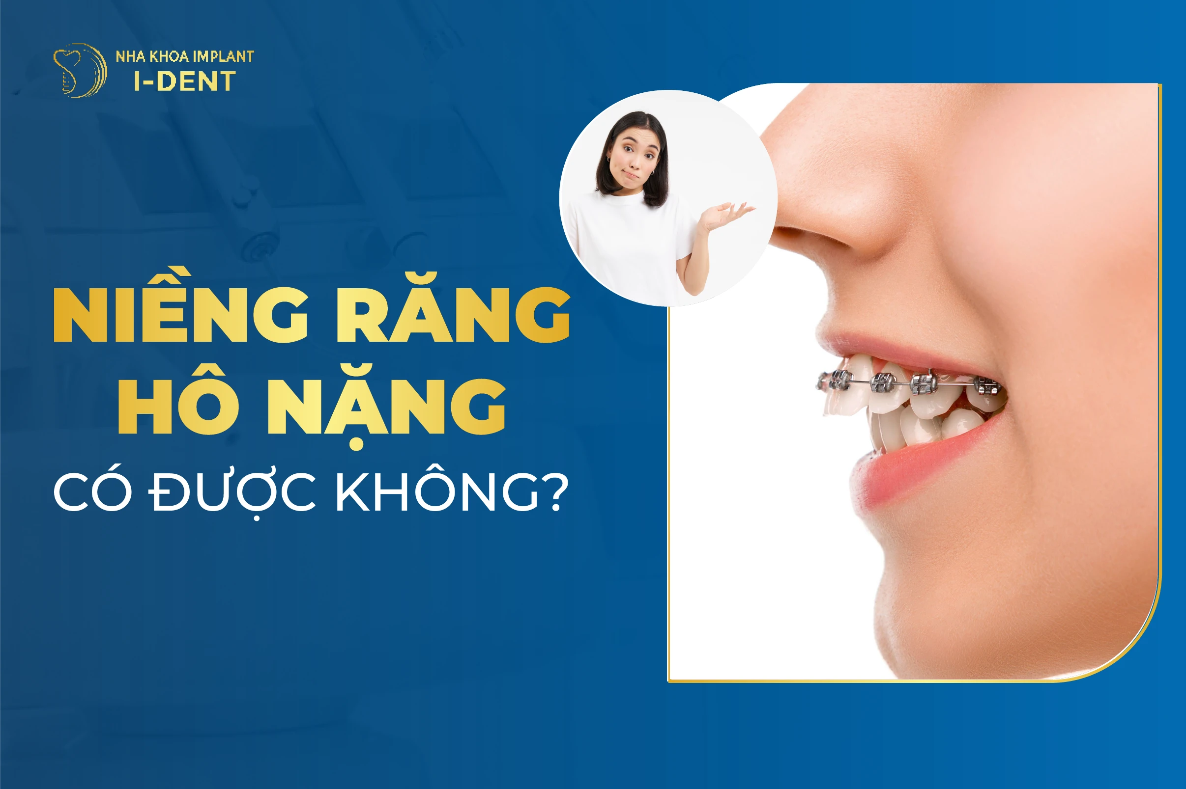 Niềng Răng Hô Nặng Có Được Không? Phương Pháp Điều Trị Hiệu Quả
