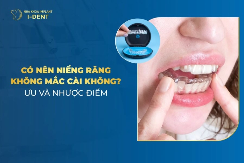 Niềng Răng Không Mắc Cài Là Gì? Có Mấy Loại?