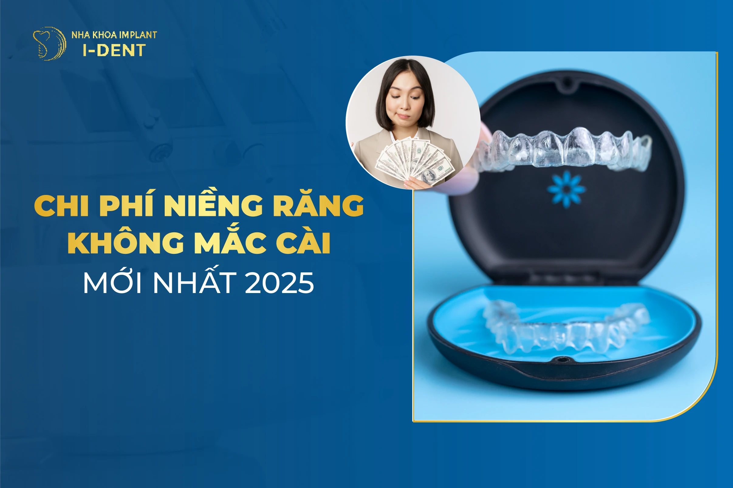 Chi Phí Niềng Răng Không Mắc Cài Mới Nhất 2026