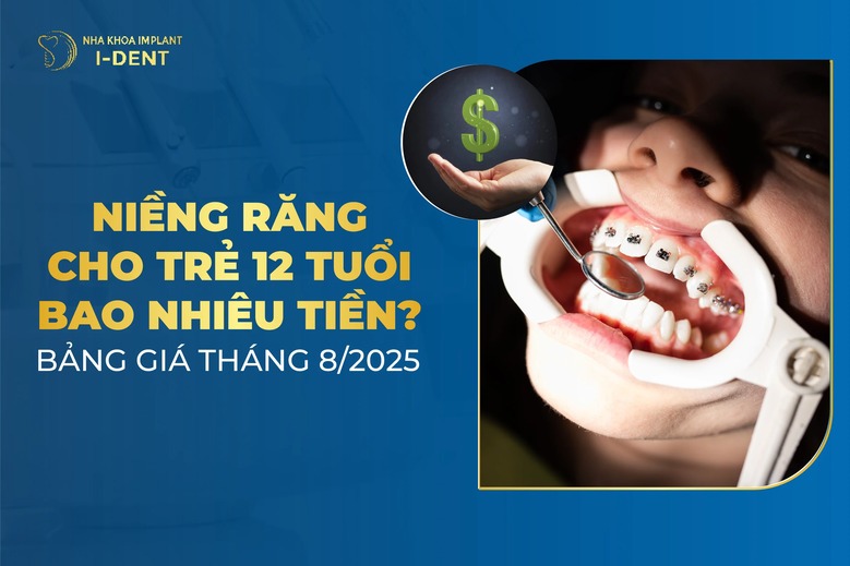 Trẻ 12 tuổi niềng răng bao nhiêu tiền? Có nên niềng không?