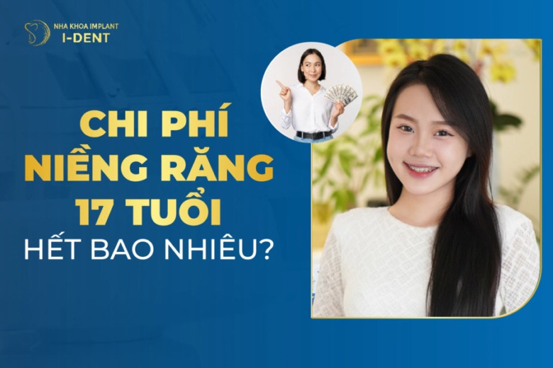Chi Phí Niềng Răng 17 Tuổi Hết Bao Nhiêu? Có Đắt Không?