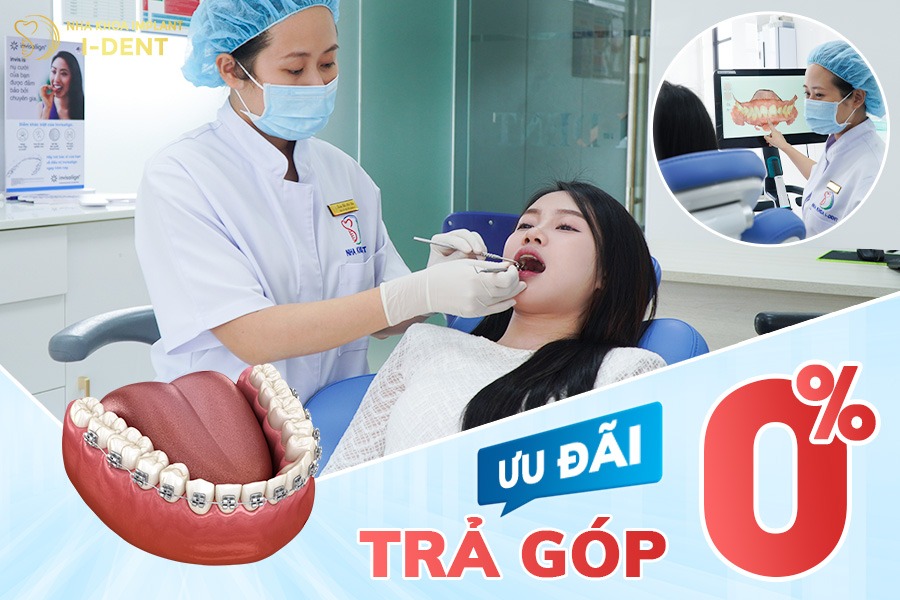 Chương trình niềng răng với thanh toán trả góp 0%