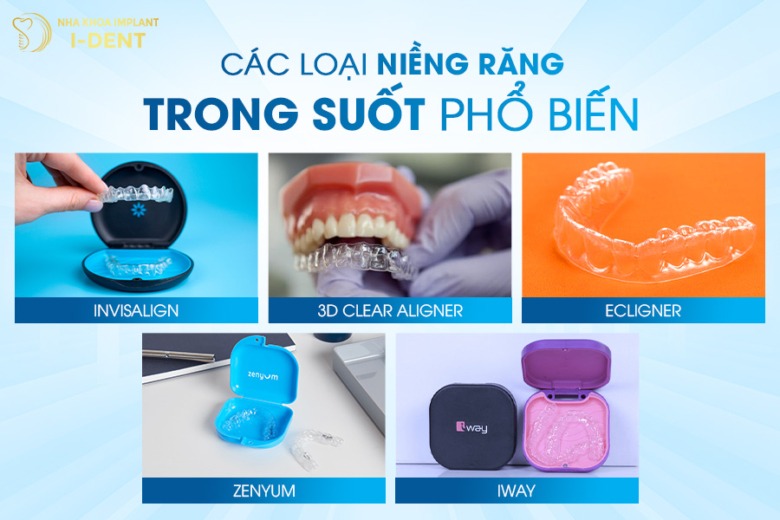 Các Loại Niềng Răng Trong Suốt Phổ Biến Nhất Hiện Nay
