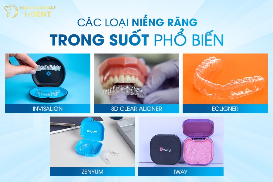 Các Loại Niềng Răng Trong Suốt Phổ Biến Nhất Hiện Nay