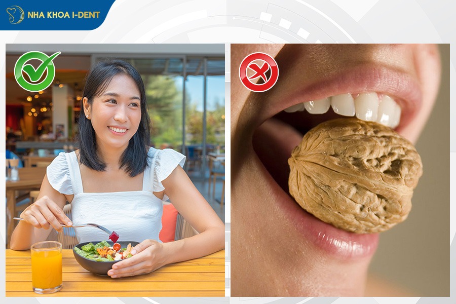 cảm giác sau khi gắn răng sứ