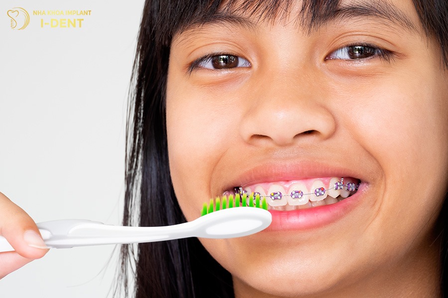 Chăm sóc răng sau niềng ngăn sâu răng, viêm nướu và duy trì kết quả lâu dài.