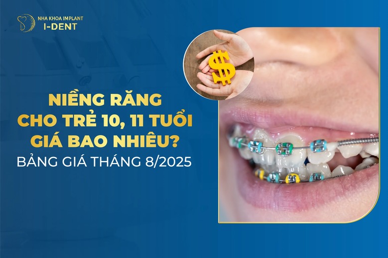 Niềng Răng Cho Trẻ 10 Tuổi Giá Bao Nhiêu? Bảng Giá Tháng 2/2026