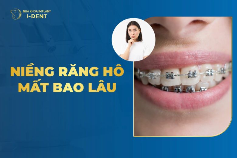Niềng Răng Hô Nhẹ Mất Bao Lâu Có Hiệu Quả?