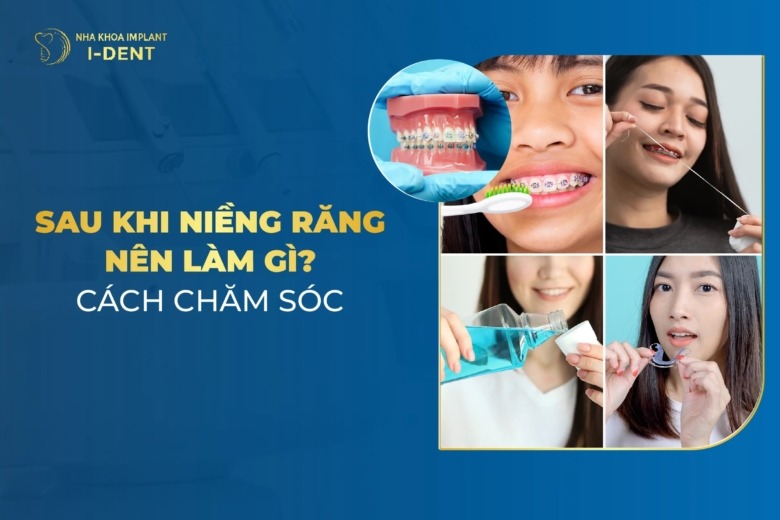 Lưu Ý Chăm Sóc Sau Khi Tháo Niềng Răng