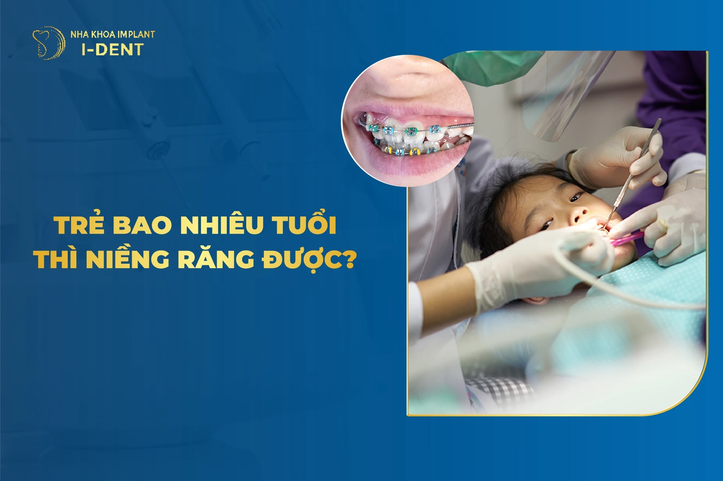 Khi Nào Nên Niềng Răng Cho Trẻ? Độ Tuổi Phù Hợp?