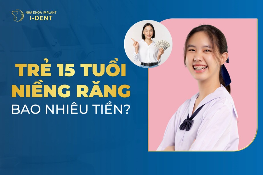 Trẻ 15 Tuổi Niềng Răng Bao Nhiêu Tiền? Bảng Giá 2025