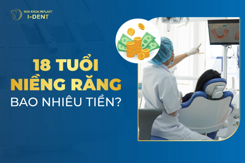 18 Tuổi Niềng Răng Bao Nhiêu Tiền Và Mất Bao Lâu?