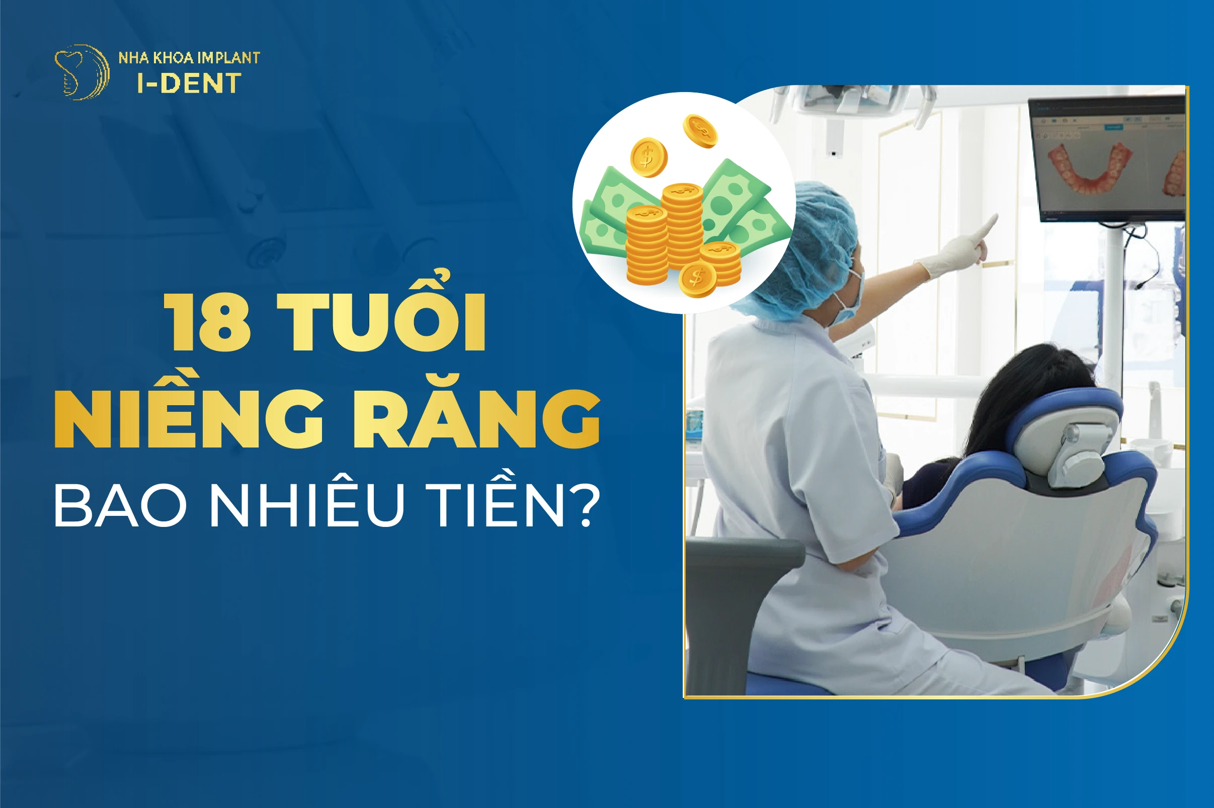18 Tuổi Niềng Răng Bao Nhiêu Tiền Và Mất Bao Lâu?