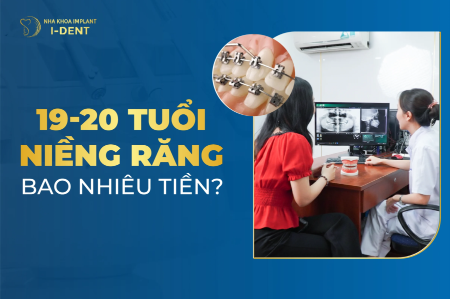 19 tuổi niềng răng bao nhiêu tiền