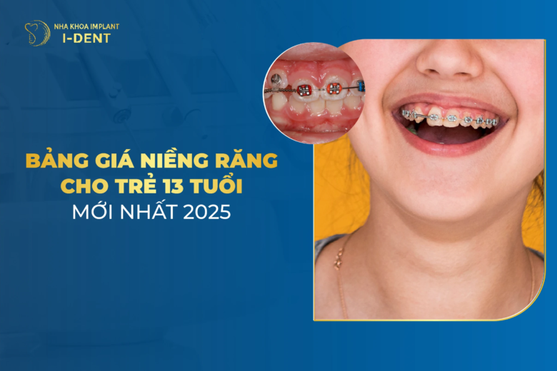 Chi Phí Niềng Răng Cho Trẻ 13 Tuổi Hết Bao Nhiêu Tiền?