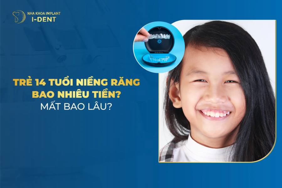 giá niềng răng cho trẻ 14 tuổi