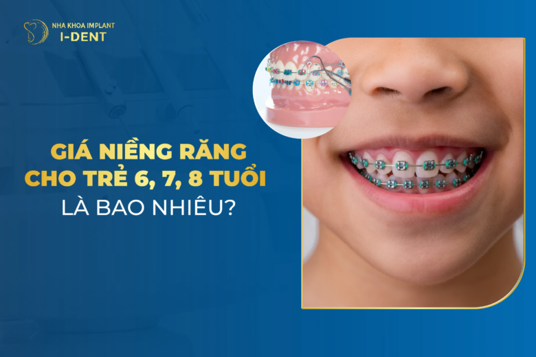 Giá Niềng Răng Cho Trẻ 6, 7, 8 Tuổi Là Bao Nhiêu?