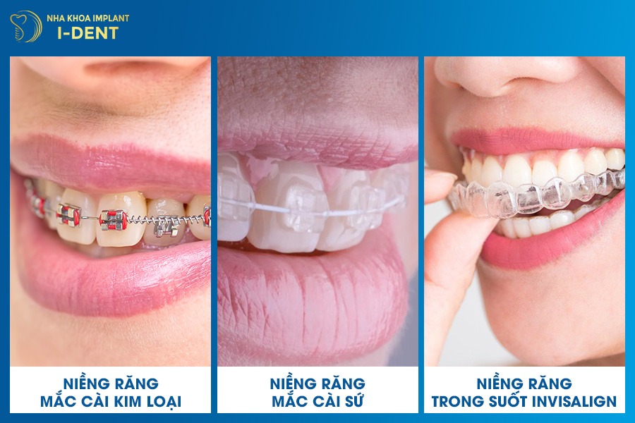 lớn tuổi có nên niềng răng