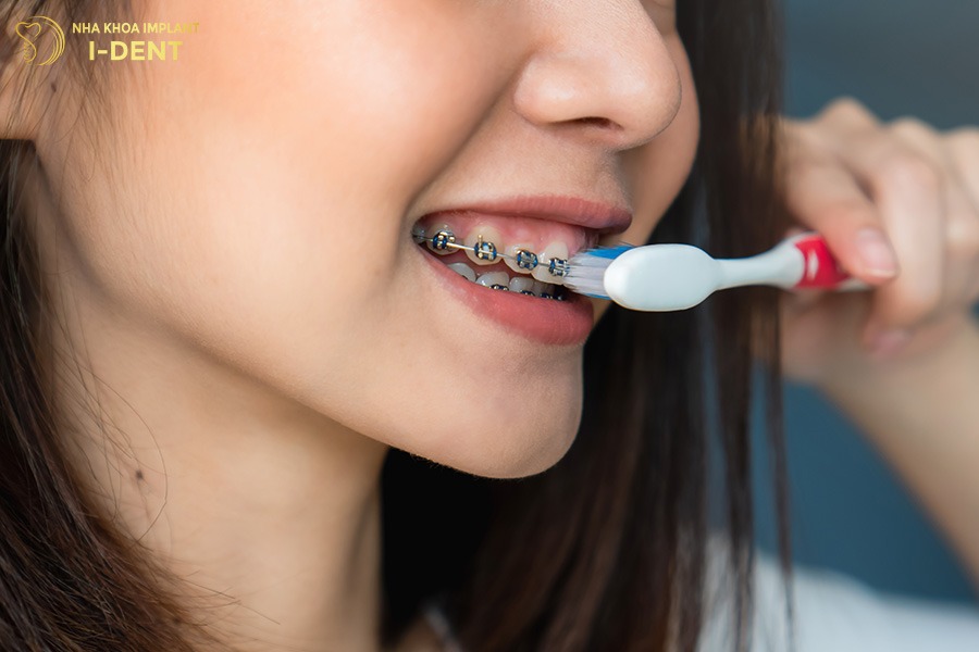 lớn tuổi có niềng răng được không