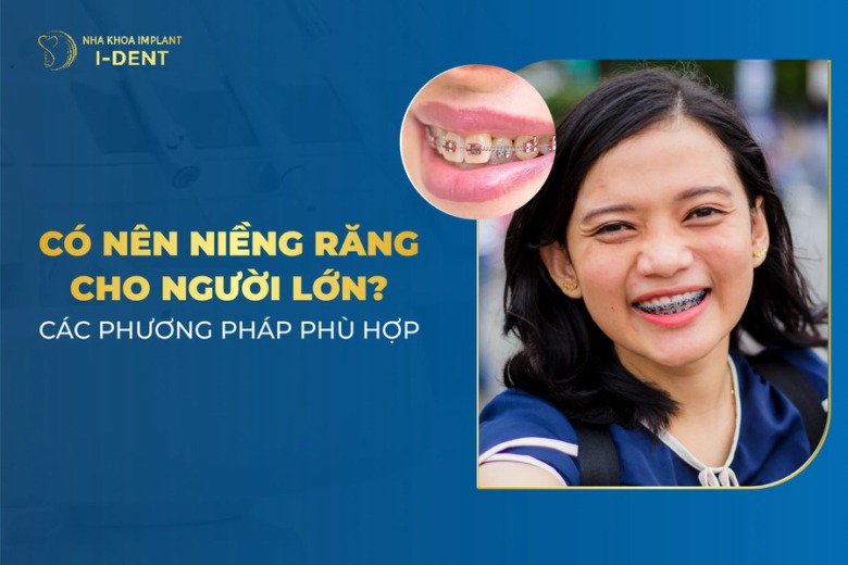 Có Nên Niềng Răng Cho Người Lớn? Các Phương Pháp Phù Hợp