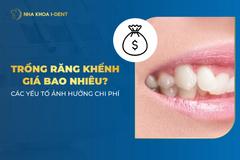 Làm răng khểnh giá bao nhiêu tiền? Phương pháp nào?