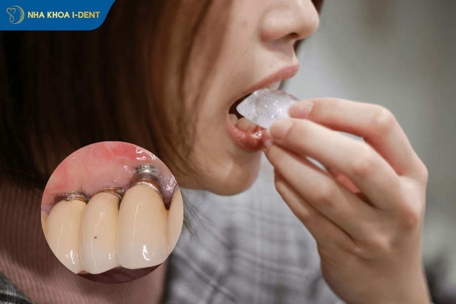 an-nhai-khong-dung-chi-dinh