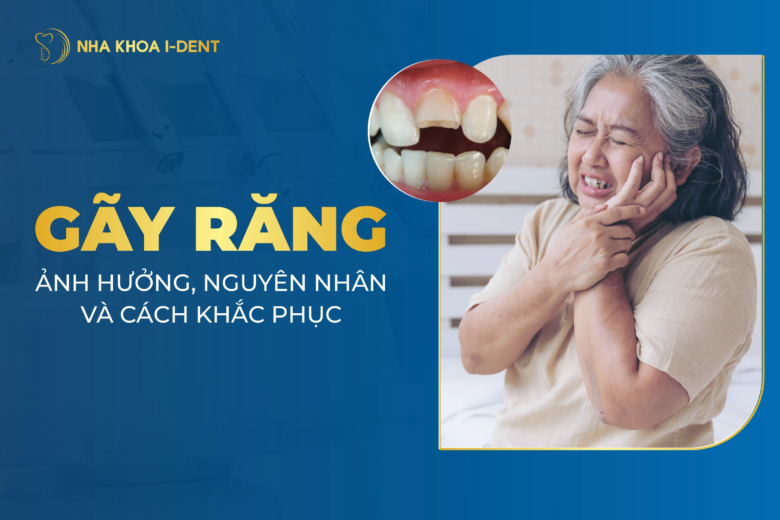 Gãy răng: Ảnh hưởng, nguyên nhân và cách xử lý