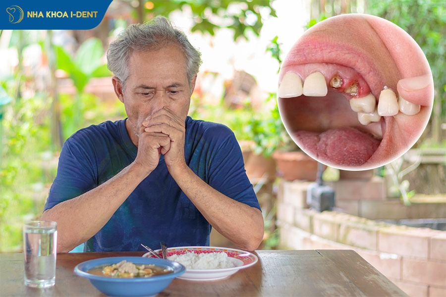 Gãy răng gây cản trở và suy giảm khả năng ăn uống