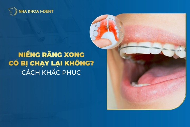 Niềng Răng Xong Có Bị Chạy Lại Không? Nguyên Nhân?