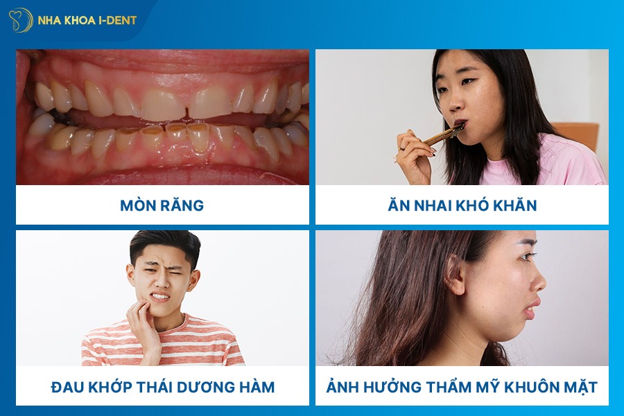 niềng răng khớp cắn sâu bao nhiêu tiền