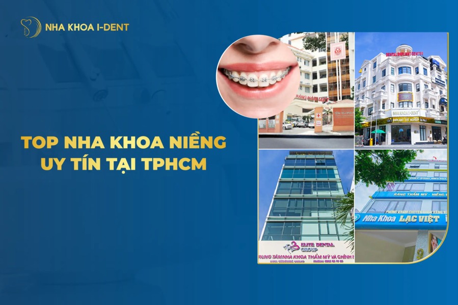 Top 10 Nha Khoa Niềng Răng Uy Tín Và Tốt Nhất Tại TPHCM