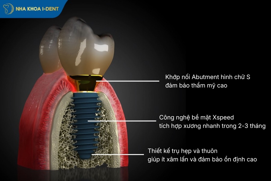 tru-implant-megagen-han-quoc