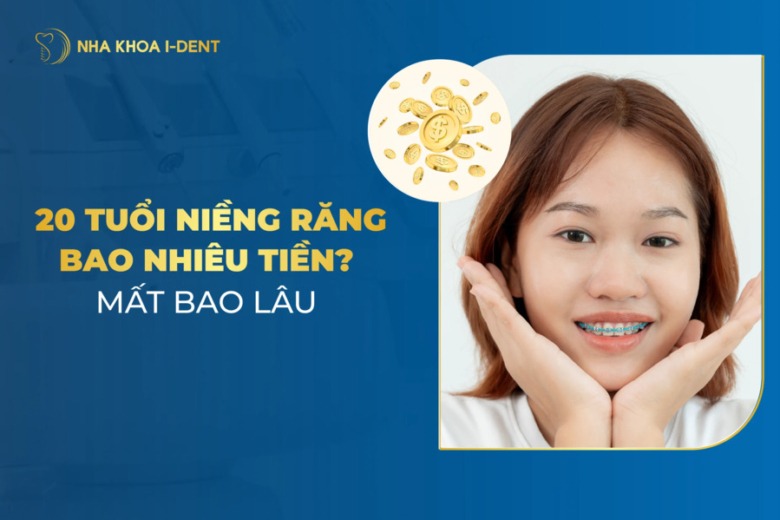 Giá niềng răng 20 tuổi bao nhiêu tiền? Niềng mất bao lâu?