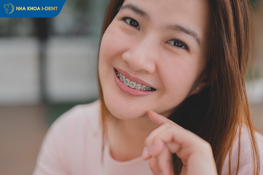 25 tuổi có niềng răng được không